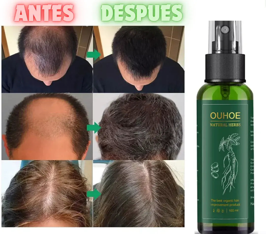 OUHOE – Spray Capilar Natural para el Crecimiento y Control de la Caída